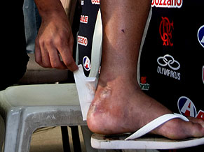 Adriano Médico do Flamengo libera Adriano para jogar domingo