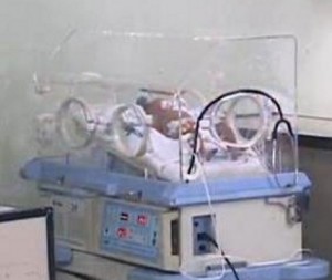 Criança continua com tratamento especiais em hospital