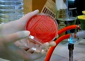 Bactéria Alemanha descobriram a bactéria E.coli em folhas de alface, em uma área da região de Fürth, na Baviera