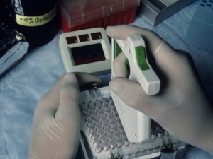 Por falta de reagentes, Ministério da Saúde limita exames de carga viral em pacientes com aids Por falta de reagentes, Ministério da Saúde limita exames de carga viral em pacientes com aids