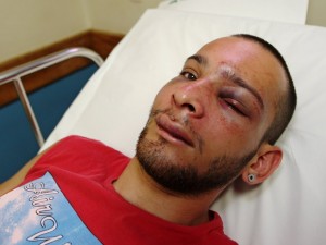Vitor Cunha, de 21 anos, foi agredido por defender morador de rua no Rio de Janeiro Vitor Cunha, de 21 anos, foi agredido por defender morador de rua no Rio de Janeiro
