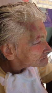 Avó de Isadora de 65 anos foi atingida por vândalos e xenófobos Avó de Isadora de 65 anos foi atingida por vândalos e xenófobos