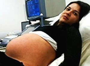 Filha de grávida morta em assalto deixou o Hospital Municipal do Campo Limpo