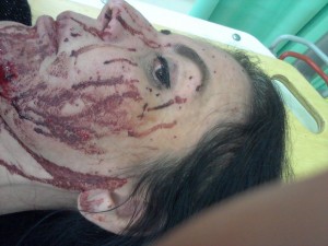 Andréa foi atingida de raspão na cabeça e a atravessou o carro e ficou presa na porta