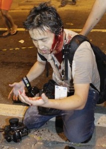 Fotógrafo da AFP atingido pela PM no Rio Fotógrafo da AFP atingido pela PM no Rio